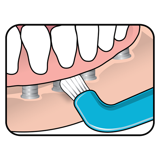 Tepe-compact-tuft-reinigen-implantaten