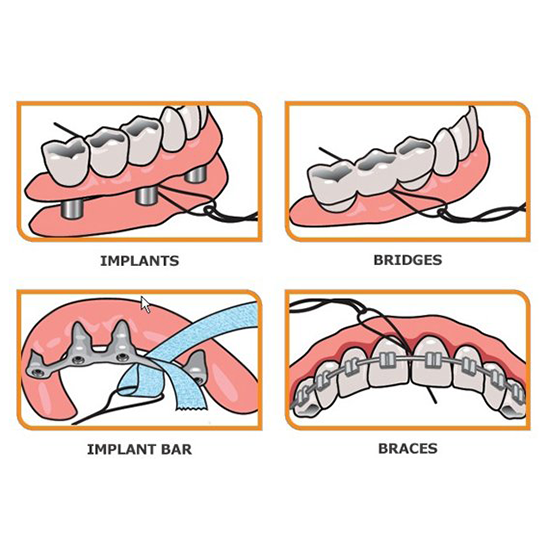 idontix-x-threaders-30-stuks-brugnaalden